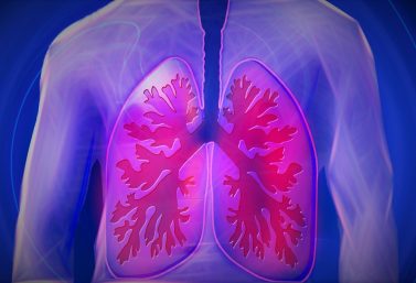 Van kwaad tot erger behandeld: COPD-medicatie